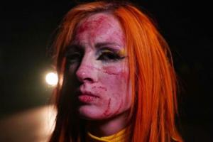 PHOTO: Becky Lynch Shows Off Boody Face After WWE Night Of Champions Loss