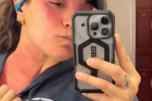 Raquel Rodriguez Opens Up About Mast Cell Activation Syndrome (MCAS) Battle In A Heartbreaking Video